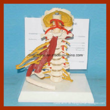 Full Size Deluxe Cervical Wirbel Muskeln Anatomie Modelle mit Vollnerv